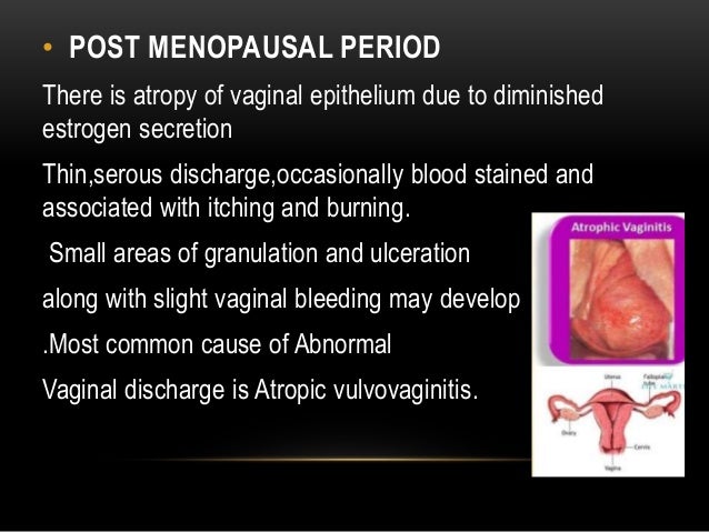 excesive vaginal discharge and itch Home made glory hole videos